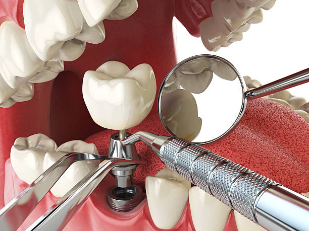 Best Emergency Dental Care for Trauma or Injury in Bryan, TX